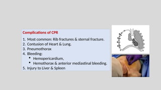 Basic life support and cardiopulmonary resuscitation | PPTX