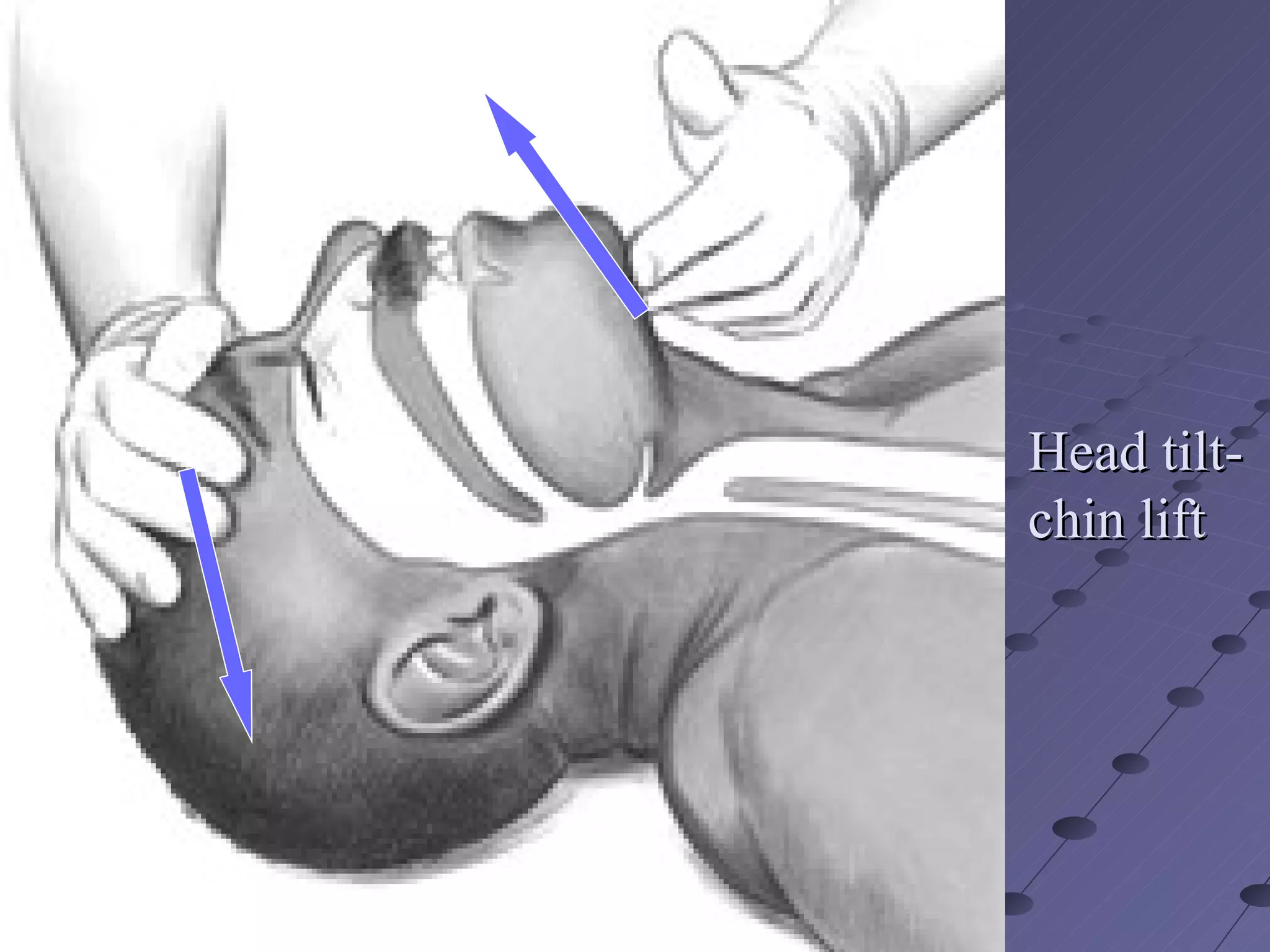 CPR( Cardiopulmonary Resuscitation | PPT