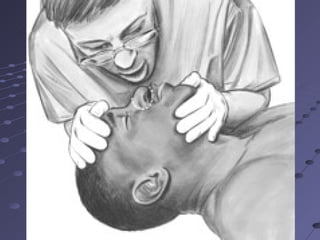 CPR( Cardiopulmonary Resuscitation | PPT