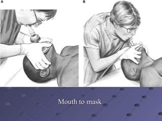 CPR( Cardiopulmonary Resuscitation | PPT