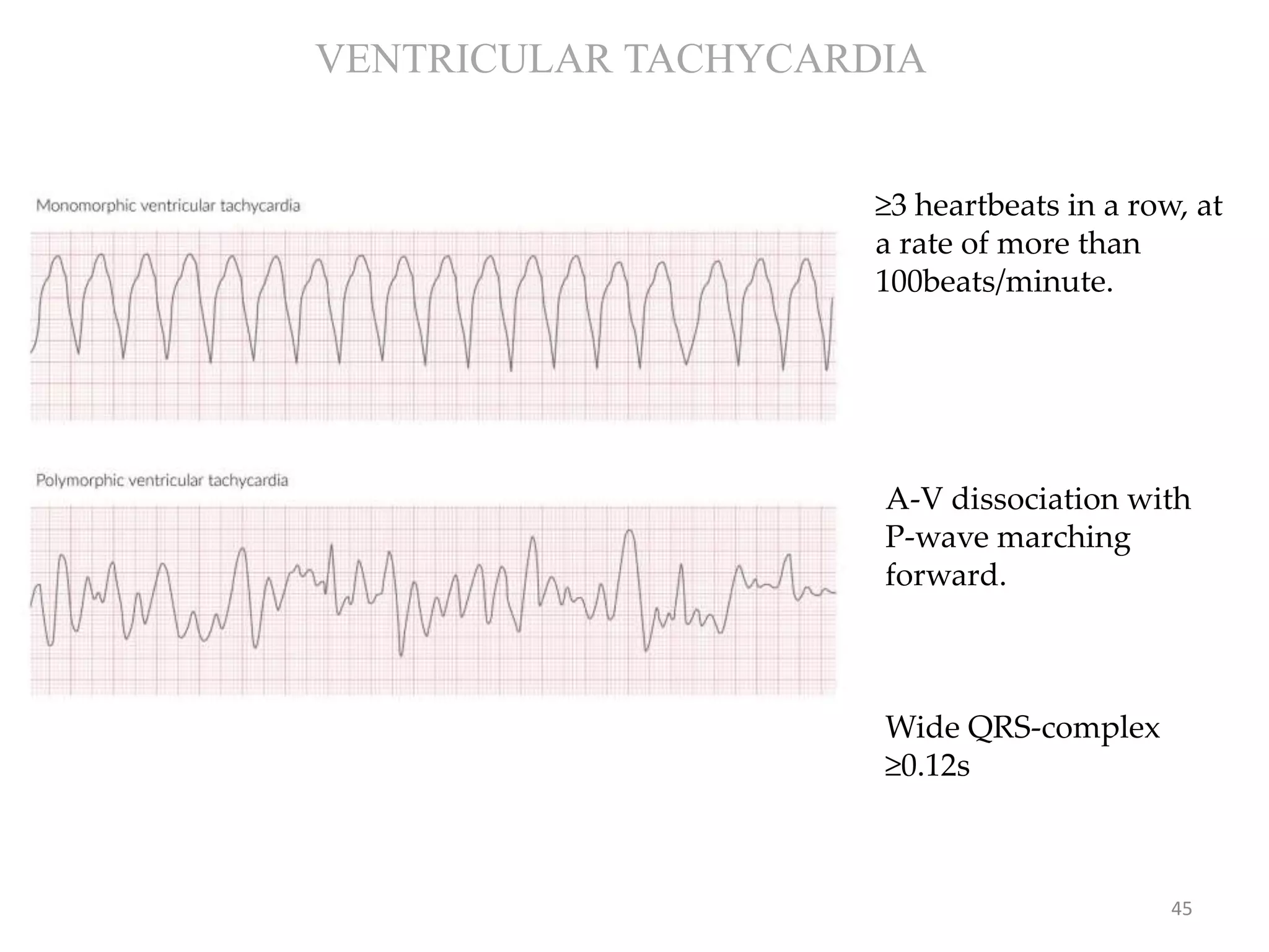 CPR: CARDIOPULMONARY RESUSCITATION- BLS & ACLS-2020 AHA UPDATE | PPTX