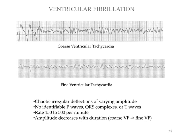 CPR: CARDIOPULMONARY RESUSCITATION- BLS & ACLS-2020 AHA UPDATE | PPTX ...
