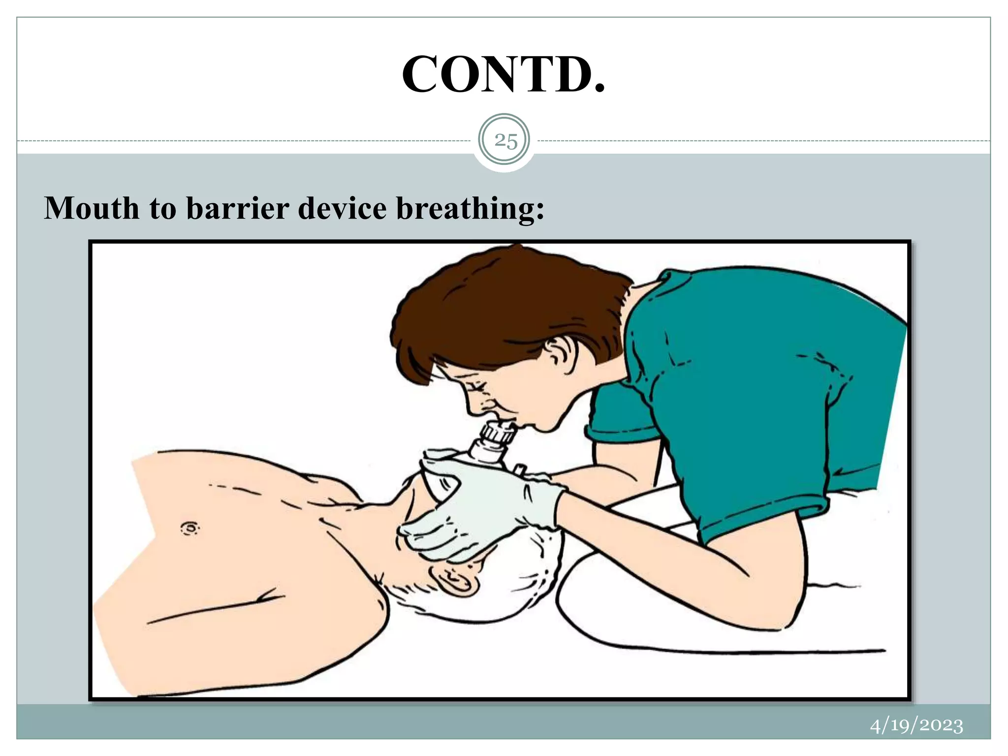 CONTD.
Mouth to barrier device breathing:
4/19/2023
25
 