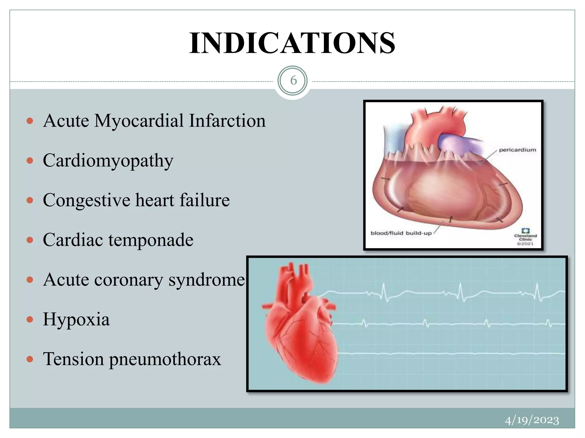 INDICATIONS
 Acute Myocardial Infarction
 Cardiomyopathy
 Congestive heart failure
 Cardiac temponade
 Acute coronary syndrome
 Hypoxia
 Tension pneumothorax
4/19/2023
6
 