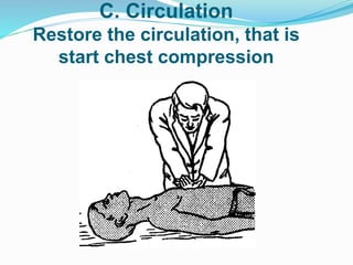C. Circulation
Restore the circulation, that is
start chest compression
 