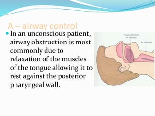 A – airway control
In an unconscious patient,
airway obstruction is most
commonly due to
relaxation of the muscles
of the tongue allowing it to
rest against the posterior
pharyngeal wall.
 