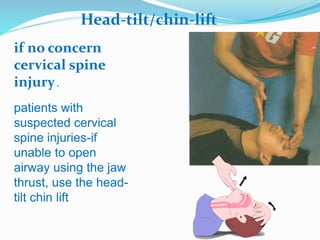 Head-tilt/chin-lift
if no concern
cervical spine
injury.
patients with
suspected cervical
spine injuries-if
unable to open
airway using the jaw
thrust, use the head-
tilt chin lift
 