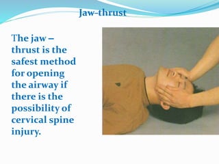 Jaw-thrust
The jaw –
thrust is the
safest method
for opening
the airway if
there is the
possibility of
cervical spine
injury.
 