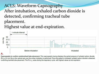 ACLS: Waveform Capnography
After intubation, exhaled carbon dioxide is
detected, confirming tracheal tube
placement.
Highest value at end-expiration.
 