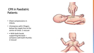 CPR in Paediatric
Patients
• Chest compressions in
Infants
• •Compress with 2 fingers
below the nipple line at the
centre of chest: 1-rescuer
• • With both hands
supporting the back –
compress with both thumbs:
2-rescuer
 