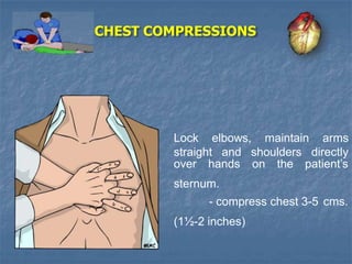 Chest Compression Test Cpr new | PPTX