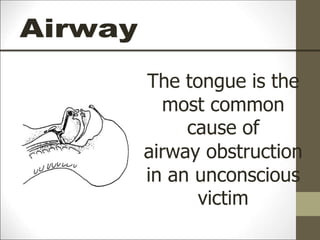 The tongue is the
most common
cause of
airway obstruction
in an unconscious
victim
 
