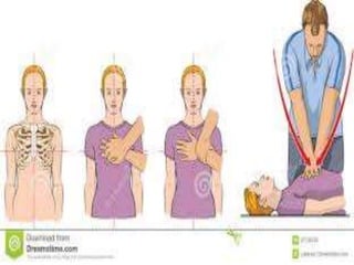 Cpr ppt | PPTX