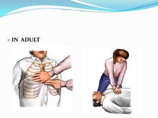 Cpr ppt | PPTX