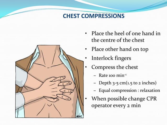 Cpr Ppt PPT