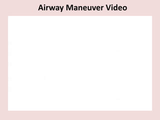 Airway Maneuver Video
 