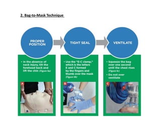 2. Bag-to-Mask Technique
 