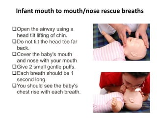 Infant mouth to mouth/nose rescue breaths
Open the airway using a
head tilt lifting of chin.
Do not tilt the head too far
back.
Cover the baby's mouth
and nose with your mouth
Give 2 small gentle puffs.
Each breath should be 1
second long.
You should see the baby's
chest rise with each breath.
 