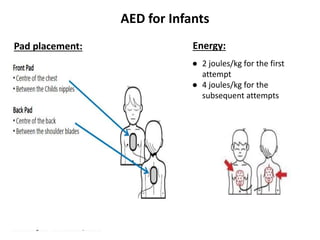 AED for Infants
Pad placement: Energy:
● 2 joules/kg for the first
attempt
● 4 joules/kg for the
subsequent attempts
 