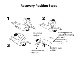 Hand supporting
the head
Bent arm gives
stability
Bent leg prevents
casualty from rolling
forward
Head tilted
well back
 
