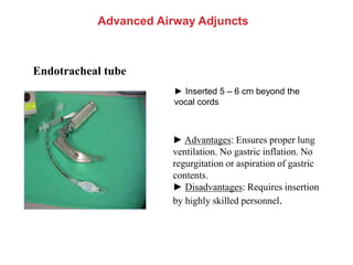 Advanced Airway Adjuncts
Endotracheal tube
► Advantages: Ensures proper lung
ventilation. No gastric inflation. No
regurgitation or aspiration of gastric
contents.
► Disadvantages: Requires insertion
by highly skilled personnel.
► Inserted 5 – 6 cm beyond the
vocal cords
 
