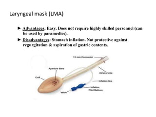 Laryngeal mask (LMA)
► Advantages: Easy. Does not require highly skilled personnel (can
be used by paramedics).
► Disadvantages: Stomach inflation. Not protective against
regurgitation & aspiration of gastric contents.
 