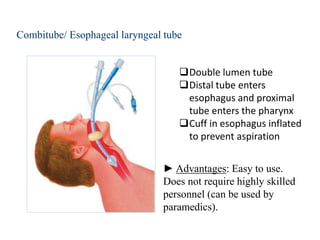 Combitube/ Esophageal laryngeal tube
Double lumen tube
Distal tube enters
esophagus and proximal
tube enters the pharynx
Cuff in esophagus inflated
to prevent aspiration
► Advantages: Easy to use.
Does not require highly skilled
personnel (can be used by
paramedics).
 