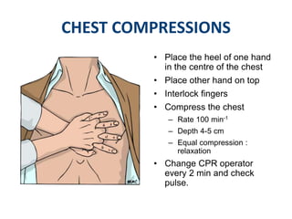 Cpr updated | PPTX