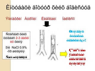 Èíòóáàöè äîòóóð õèéõ áîäèñóóä
Ýïèíåôðèí Àòðîïèí Ëèäîêàèí Íàëîêñîí
Ñóäñààð õèéõ
òóíãààñ 2-3 äàõèí
èõ õèéíý
5ìë NaCl 0.9%
-îîð øèíãýëíý
Ñàéí øèìýãääýã
Øèìýãäýõ
õóãàöàà
òîäîðõîéã¿é!
Çºâõºí ìàø
ÿàðàëòàé
òîõèîëäîëä
õýðýãëýíý
 