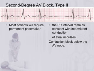 acls | PPTX
