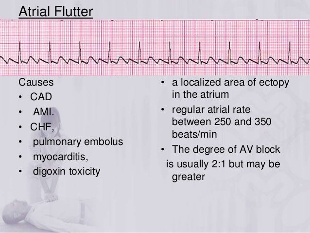 Acls