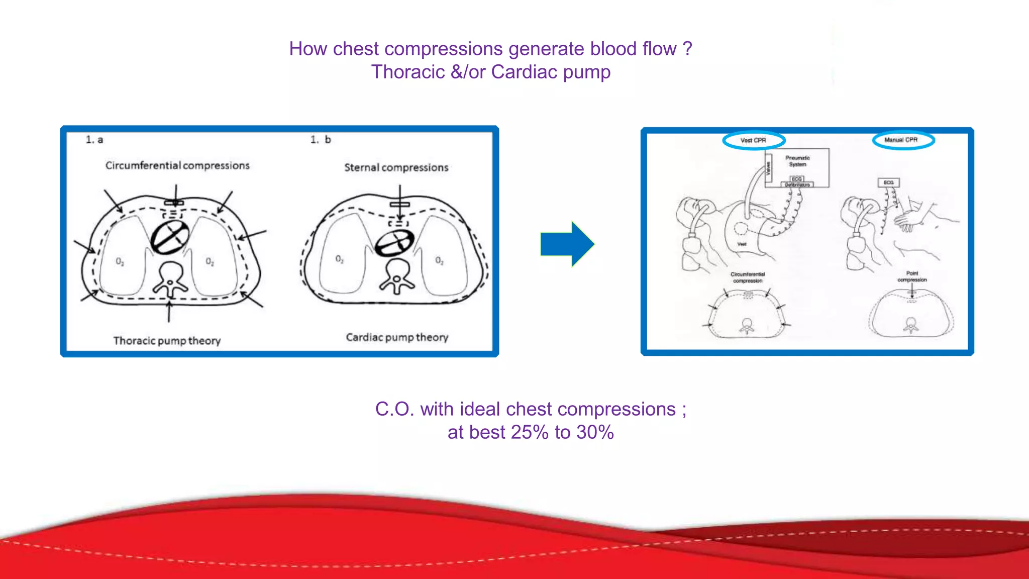 How chest compressions generate blood flow ?
Thoracic &/or Cardiac pump
C.O. with ideal chest compressions ;
at best 25% to 30%
 