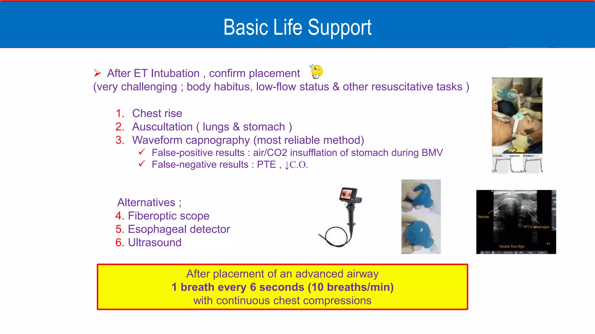 Basic Life Support
 After ET Intubation , confirm placement
(very challenging ; body habitus, low-flow status & other resuscitative tasks )
1. Chest rise
2. Auscultation ( lungs & stomach )
3. Waveform capnography (most reliable method)
 False-positive results : air/CO2 insufflation of stomach during BMV
 False-negative results : PTE , ↓C.O.
Alternatives ;
4. Fiberoptic scope
5. Esophageal detector
6. Ultrasound
After placement of an advanced airway
1 breath every 6 seconds (10 breaths/min)
with continuous chest compressions
 