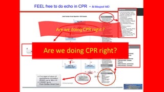 FEEL free to do echo in CPR - M.Masjedi MD
Are we doing CPR right ?
 
