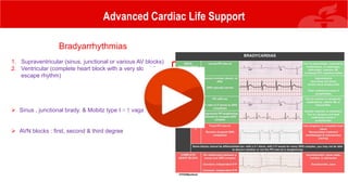 Advanced Cardiac Life Support
Bradyarrhythmias
1. Supraventricular (sinus, junctional or various AV blocks)
2. Ventricular (complete heart block with a very slow idiovent.
escape rhythm)
 Sinus , junctional brady. & Mobitz type I ≈ ↑ vagal tone
 AVN blocks : first, second & third degree
 