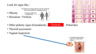 Look for signs like :
• Obesity
• Hirsutism / Virilism
• Other puberty signs (Gonadarche, , Pubarche)
• Thyroid assessment
• Vaginal inspection
Thelarche
 