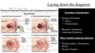 Laying down the diagnosis
Secondary Amenorrhea
• Pituitary Disorders
• Stress
• Prolactinoma
• Sheehan’s Syndrome
• Asherman Syndrome
Other notable endocrine disorder
• Ovarian failure / Menopause
• PCOS
• Ovarian Tumors
Primary Amenorrhea
Female & Sexually Developed
• Vaginal Atresia
• Imperforate Hymen
• Swyer syndrome (XY Female)
• Leptin deficiency
• Constitutional delay of menarche
Female w Sexual Infantilism
• Turners syndrome
• Gonadal Dysgenesis
• Pan-Hypopituitarism
Female w Virilism
• CAH (Adult onset)
• XY Female
 