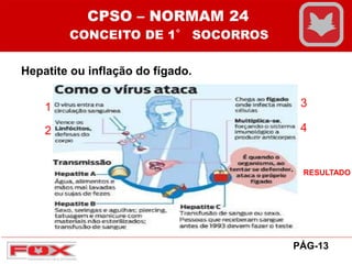 Hepatite ou inflação do fígado.
PÁG-13
CPSO – NORMAM 24
CONCEITO DE 1° SOCORROS
1
2
3
4
RESULTADO
 