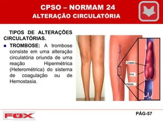TIPOS DE ALTERAÇÕES
CIRCULATÓRIAS.
 TROMBOSE: A trombose
consiste em uma alteração
circulatória oriunda de uma
reação Hipermétrica
(Heterométrica) do sistema
de coagulação ou de
Hemostasia.
CPSO – NORMAM 24
ALTERAÇÃO CIRCULATÓRIA
PÁG-57
 