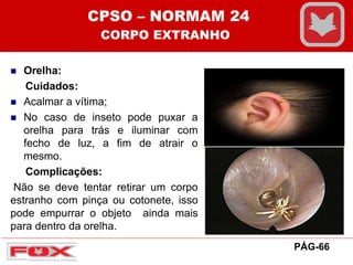  Orelha:
Cuidados:
 Acalmar a vítima;
 No caso de inseto pode puxar a
orelha para trás e iluminar com
fecho de luz, a fim de atrair o
mesmo.
Complicações:
Não se deve tentar retirar um corpo
estranho com pinça ou cotonete, isso
pode empurrar o objeto ainda mais
para dentro da orelha.
CPSO – NORMAM 24
CORPO EXTRANHO
PÁG-66
 
