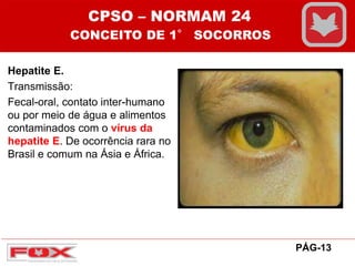 Hepatite E.
Transmissão:
Fecal-oral, contato inter-humano
ou por meio de água e alimentos
contaminados com o vírus da
hepatite E. De ocorrência rara no
Brasil e comum na Ásia e África.
CPSO – NORMAM 24
CONCEITO DE 1° SOCORROS
PÁG-13
 