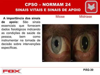 A importância dos sinais
de apoio: São sinais
essenciais que fornecem
dados fisiológicos indicando
as condições de saúde da
pessoa, bem como
instrumentar na tomada de
decisão sobre intervenções
específicas.
Miose Midriase
CPSO – NORMAM 24
SINAIS VITAIS E SINAIS DE APOIO
PÁG-30
 