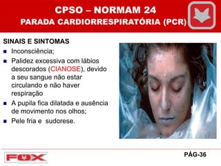 SINAIS E SINTOMAS
 Inconsciência;
 Palidez excessiva com lábios
descorados (CIANOSE), devido
a seu sangue não estar
circulando e não haver
respiração
 A pupila fica dilatada e ausência
de movimento nos olhos;
 Pele fria e sudorese.
CPSO – NORMAM 24
PARADA CARDIORRESPIRATÓRIA (PCR)
PÁG-36
 