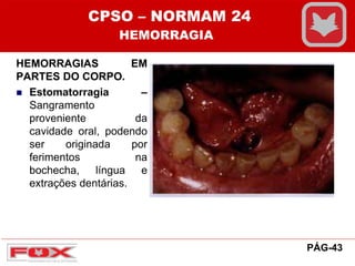 HEMORRAGIAS EM
PARTES DO CORPO.
 Estomatorragia –
Sangramento
proveniente da
cavidade oral, podendo
ser originada por
ferimentos na
bochecha, língua e
extrações dentárias.
CPSO – NORMAM 24
HEMORRAGIA
PÁG-43
 