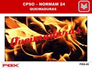 CPSO – NORMAM 24
QUEIMADURAS
PÁG-45
 