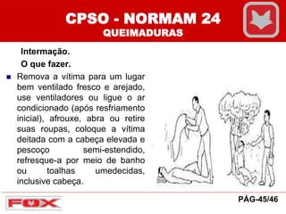 CPSO - NORMAM 24
QUEIMADURAS
Intermação.
O que fazer.
 Remova a vítima para um lugar
bem ventilado fresco e arejado,
use ventiladores ou ligue o ar
condicionado (após resfriamento
inicial), afrouxe, abra ou retire
suas roupas, coloque a vítima
deitada com a cabeça elevada e
pescoço semi-estendido,
refresque-a por meio de banho
ou toalhas umedecidas,
inclusive cabeça.
PÁG-45/46
 