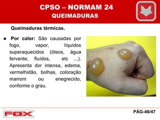 Queimaduras térmicas.
 Por calor: São causadas por
fogo, vapor, líquidos
superaquecidos (óleos, água
fervente, fluídos, etc ...).
Apresenta dor intensa, edema,
vermelhidão, bolhas, coloração
marrom ou enegrecido,
conforme o grau.
CPSO – NORMAM 24
QUEIMADURAS
PÁG-46/47
 