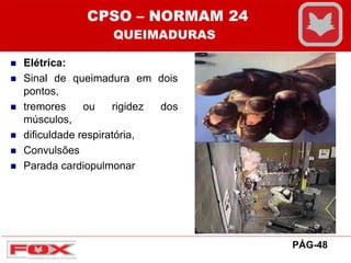  Elétrica:
 Sinal de queimadura em dois
pontos,
 tremores ou rigidez dos
músculos,
 dificuldade respiratória,
 Convulsões
 Parada cardiopulmonar
CPSO – NORMAM 24
QUEIMADURAS
PÁG-48
 