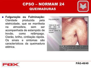  Fulguração ou Fulminação:
Claridade produzida pela
eletricidade, que se manifesta
na atmosfera, sem ser
acompanhada de estampido de
trovão, como relâmpago.
Clarão, brilho, cintilação rápida.
Os sinais e sintomas são
característicos da queimadura
elétrica.
CPSO – NORMAM 24
QUEIMADURAS
PÁG-48/49
 