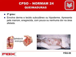  3º grau:
 Envolve derme e tecido subcutâneo ou hipoderme. Apresenta
pele marrom, enegrecida, com pouca ou nenhuma dor na área
afetada.
CPSO – NORMAM 24
QUEIMADURAS
PÁG-50
 